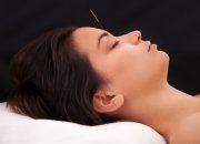 קורס דיקור סיני קוסמטי